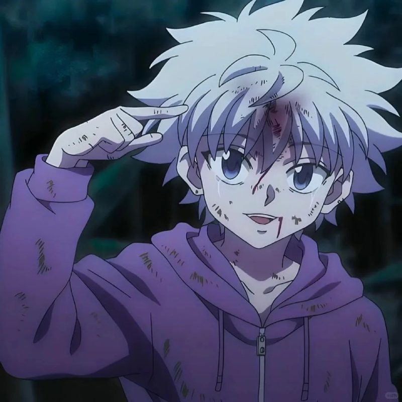 ảnh killua 17